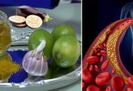 10-remédios-naturais-para-baixar-os-níveis-de-colesterol-ruim-768×384