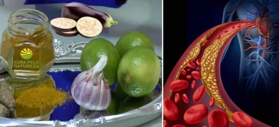10-remédios-naturais-para-baixar-os-níveis-de-colesterol-ruim-768×384
