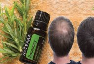 A-mistura-de-6-oleos-essenciais-que-ajudou-a-nascer-cabelo-1-696×392