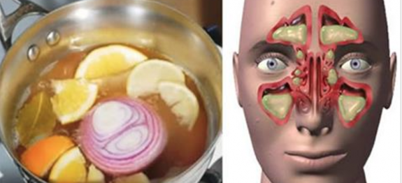 ESTA É A “BOMBA” CONTRA A CONGESTÃO NASAL E A GRIPE – VAI CURAR VOCÊ EM 24 HORAS!