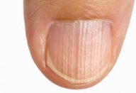 8 sintomas que indicam que seu corpo está com deficiência de proteína – e como resolver o problema