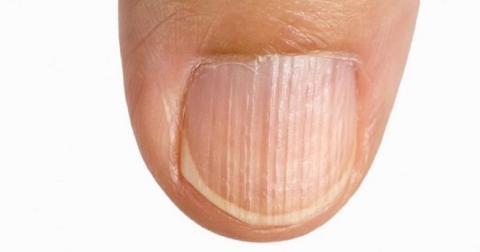 8 sintomas que indicam que seu corpo está com deficiência de proteína – e como resolver o problema