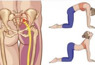 9 tratamentos naturais para você eliminar a dor no nervo ciático