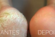 pe-rachado-produtos-de-beleza11