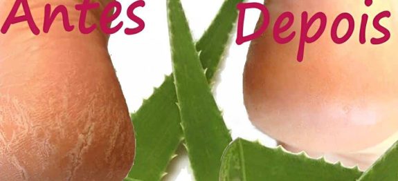 como-tirar-rachaduras-dos-pes-01-0911.jpg