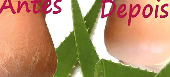 como-tirar-rachaduras-dos-pes-30-0911.jpg