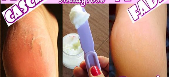 creme-caseiro-para-pes-rachados-12-10.jpg
