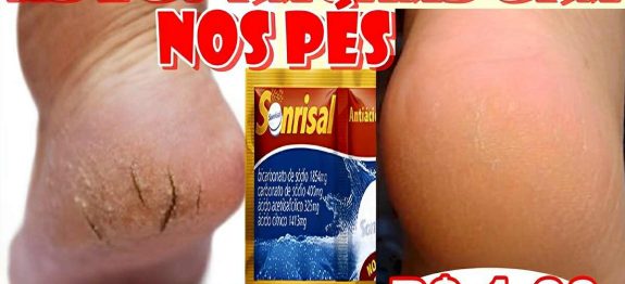 como-acabar-com-as-rachaduras-dos-pes-06-11.jpg