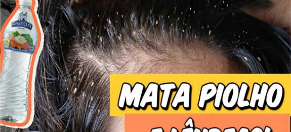 como-acabar-com-piolhos-07-03-610×300-1.jpeg